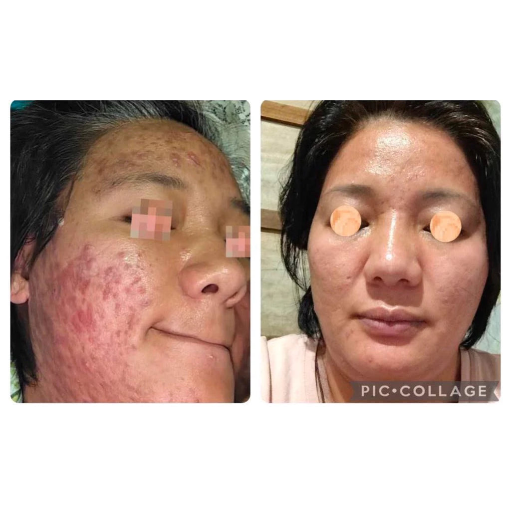 Bright Boost B12 Whitening Serum | Cinema SkinFX Philippines