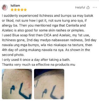 Centella CICA Allantoin Serum | Soothing Skin Repair | Cinema SkinFX