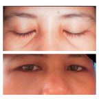 Eye Collagen Botox with Massager | Cinema SkinFX Philippines