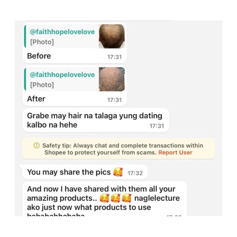 Scalp Follicle Grower Serum | Hair Growth | Cinema SkinFX Philippines