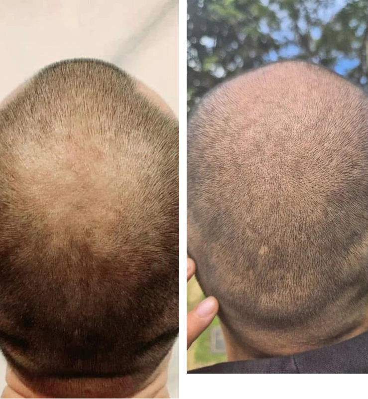 Scalp Follicle Grower Serum | Hair Growth | Cinema SkinFX Philippines