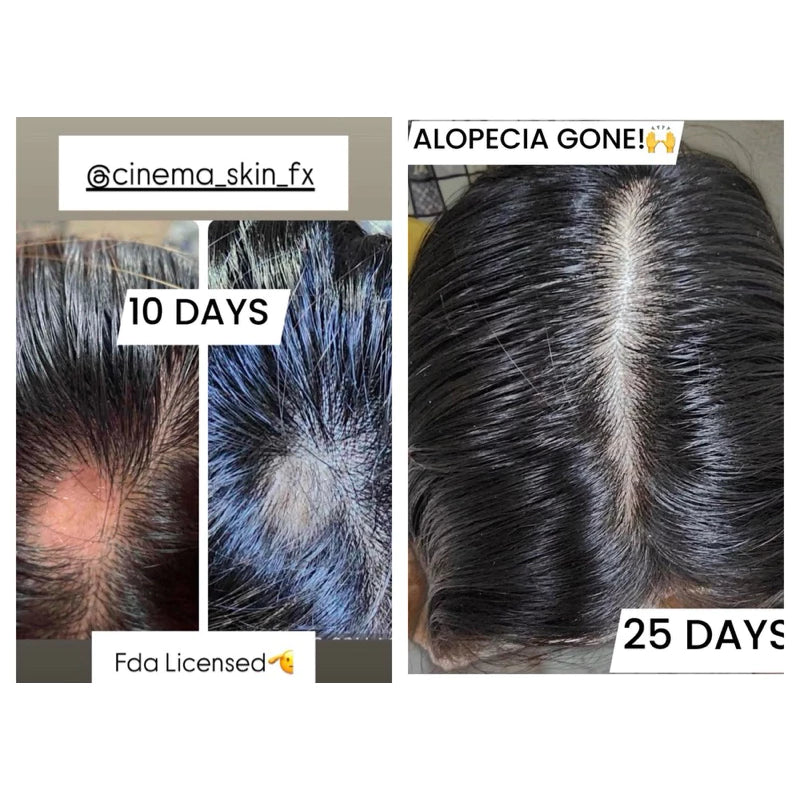 Scalp Follicle Grower Serum | Hair Growth | Cinema SkinFX Philippines