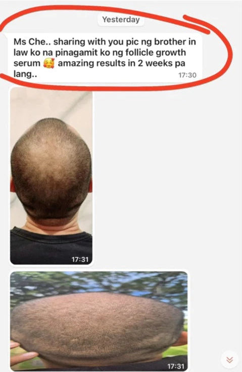 Scalp Follicle Grower Serum | Hair Growth | Cinema SkinFX Philippines